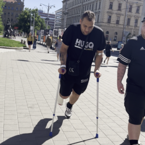 Man broken leg (video)